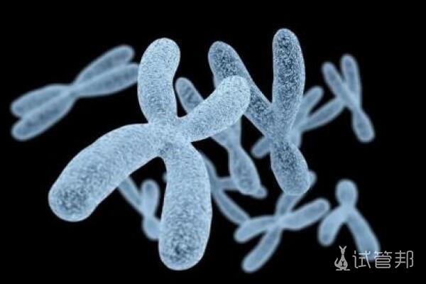 21号染色体三体的常见症状有哪些？