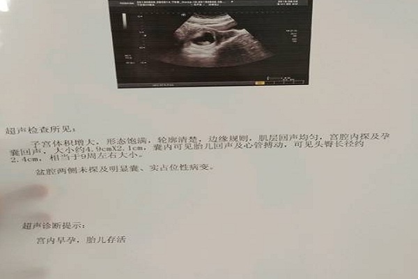 南京鼓楼医院试管婴儿成功