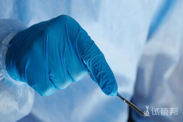 7009e5bc8334e16370f8be680fc884d3.jpg 包皮手术后需要注意哪些事项?