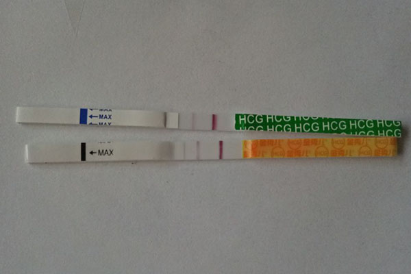 试管移植后14天验孕