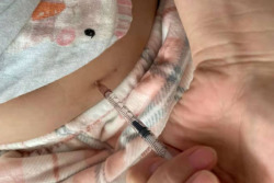 12月22日柳州市工人医院试管婴儿取卵记录