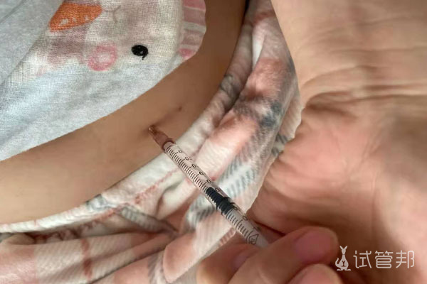 柳州市工人医院试管婴儿打促排卵针