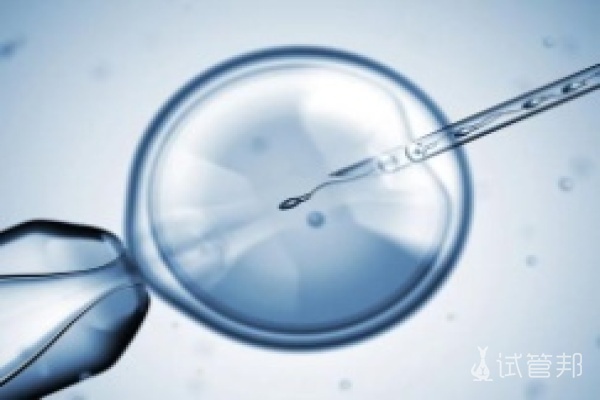 试管婴儿取卵长方案成功率多少？
