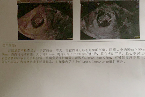 代妈招聘郑州22万起郑州哪家医院能检查不孕不育