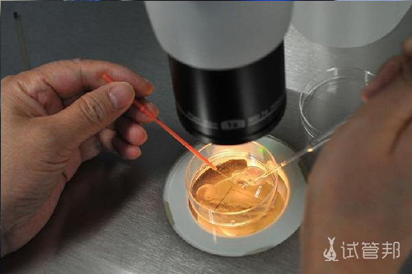 c78025c838519f29d0dc3e733b1fe3da.jpg 试管婴儿囊胚经过PGS筛选成功率是多少