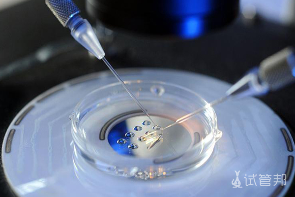 fb7c2ef3d864a92cf7ecfa573393df1d.jpg 什么是植入前基因筛查(PGS)