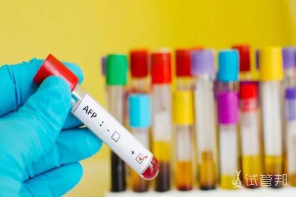 120b800fe96b4e022dec64ac480af460.jpg 甲胎蛋白检查要花多少钱?