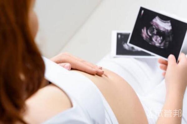 孕期做二维彩超需要注意什么