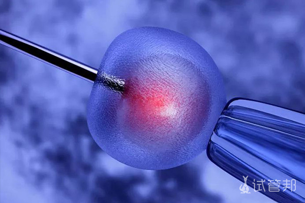 2b793b771977e4b4db2d16ecb413d742.jpg 移植环节痛吗