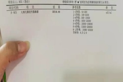 厦门妇幼保健院试管婴儿，移植4次终于成功得双胞胎