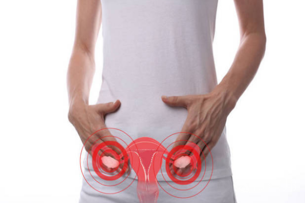 多囊卵巢综合症是什么多囊卵巢综合症是什么