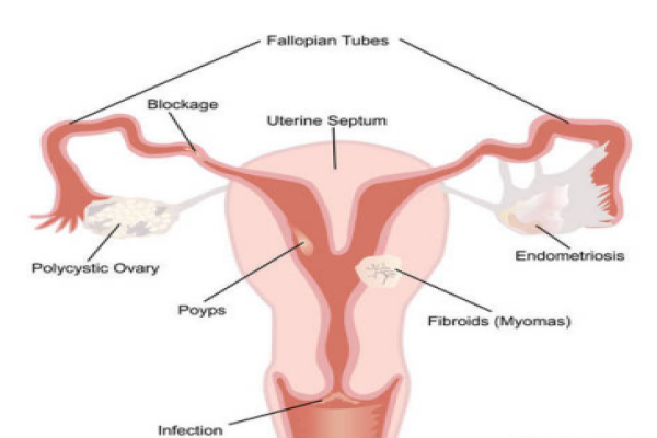 多囊卵巢综合手术后怎么护理