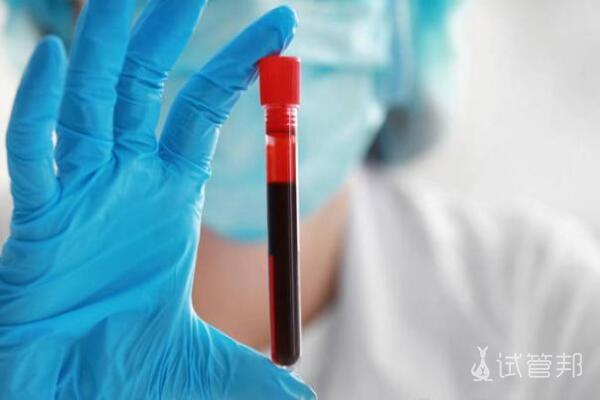 91758db5164082f1357034dbb4d79b55.jpg 谷氨酰转肽酶偏高的原因有哪些