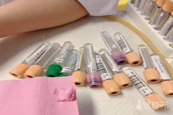 7ce59447da5874a25302a5ac18634ed4.jpg 做试管婴儿需要做哪些检查