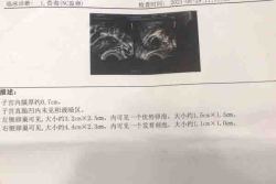 淮安市妇幼保健院试管婴儿移植后5周流产,太伤心了