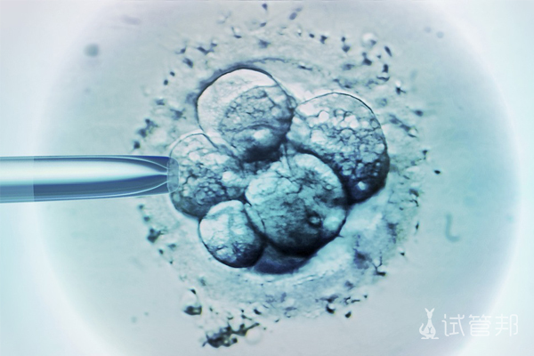 胚胎移植后腹水怎么办