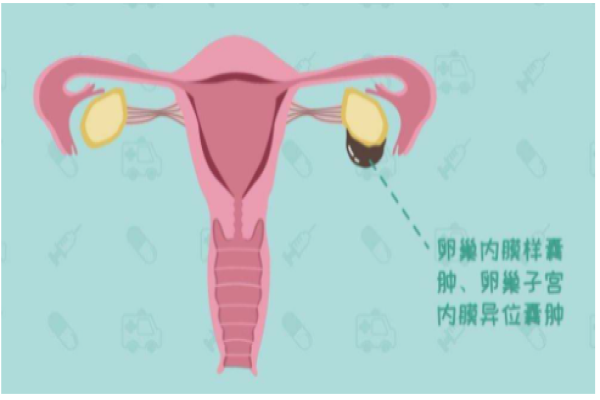 为了老公做试管值得吗女性_70后广州三代试管婴儿27天顺利“好孕”