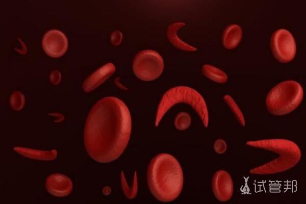 镰刀型细胞贫血症是什么