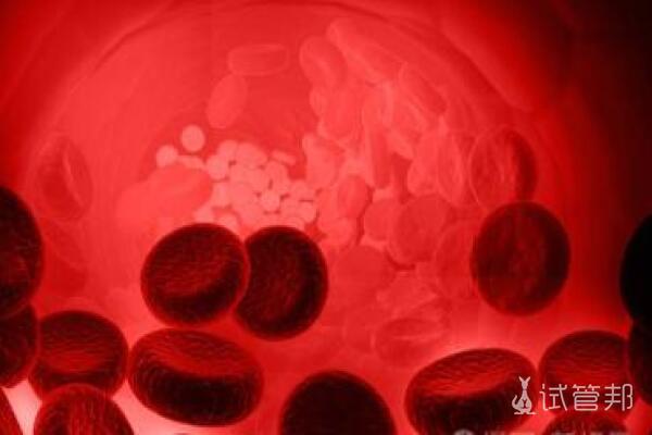 镰刀型细胞贫血症有哪些症状表现