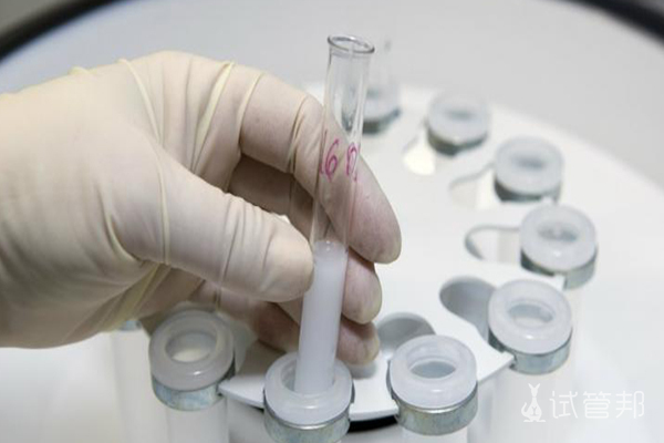 广西壮族自治区妇幼保健院可以冷冻卵子吗? 上海哪里可以<a href=