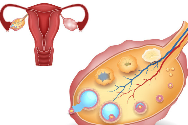 不排卵的原因