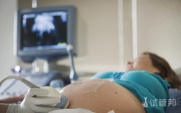 dbcaedc6371a17b267fd0d7d2281b873.jpg 优生四项有必要做吗