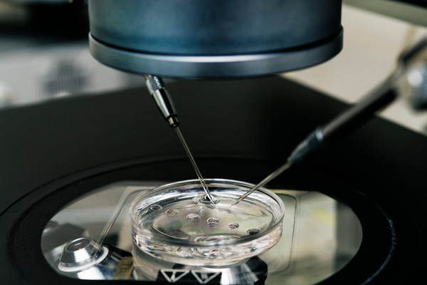 58b01e706654c1e4bfa08b08e21c31a7.png 上海试管婴儿有什么优势