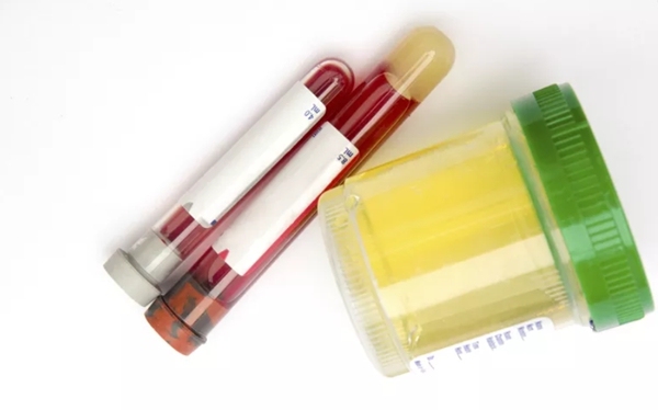 b2ea25b4fa24b9a6d9c606a8bf502214.jpg 孕前检查挂什么科