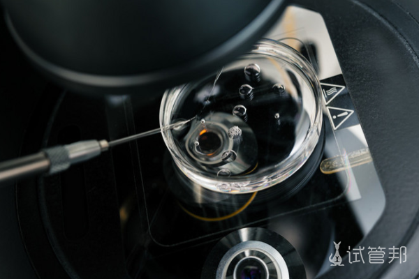 0c3eb1068119fa06e4d83b183d34d609.png 上海瑞金医院做试管婴儿