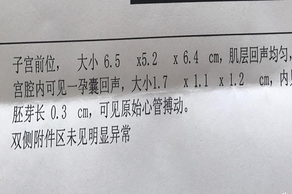 柬埔寨试管婴儿顺利结束