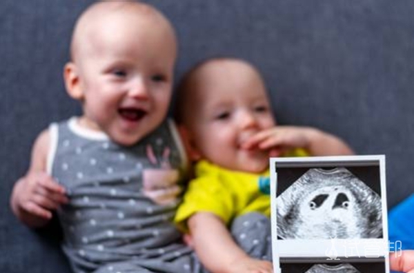 异卵双胞胎产检有哪些注意事项