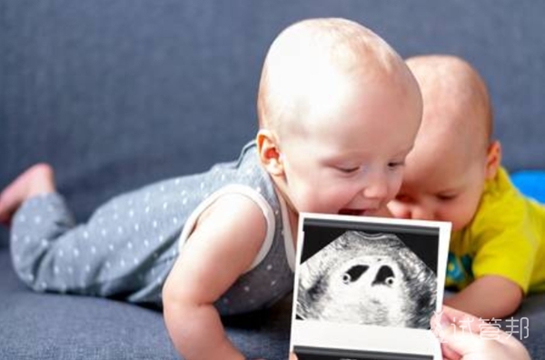 1b17cdf9ff9b24526ca1c760419bff6c.jpg 可以做试管婴儿怀双胞胎吗