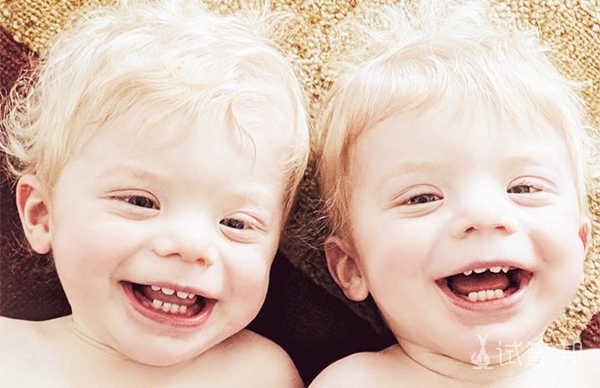 同卵双胞胎男方的遗传因素占多少