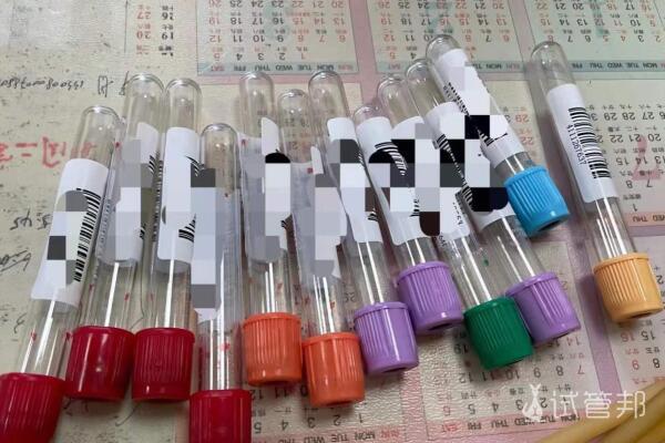 04292a88447b3fb18e3eb2f09ff90345.jpg 在昆明试管婴儿的费用是多少