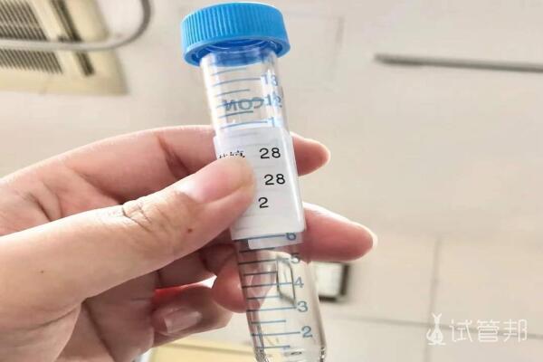 feefe779a777c9073c8d8e59f0b47f89.jpg 扬州市妇幼保健院人工授精经历