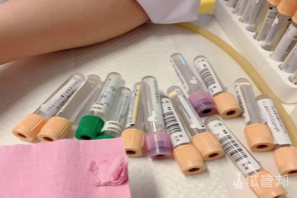 a313e8decbbb1bcedaf2cd4546138316.jpg 在邯郸市中心医院做试管婴儿多少钱