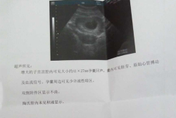 在西宁市第三人民医院试管婴儿成功好孕,真的太艰难了!