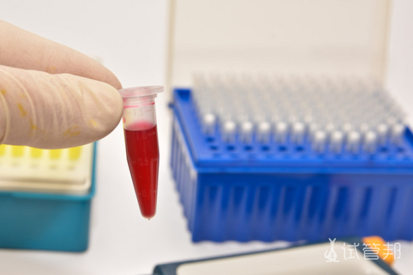 7b0fd07835a9b0dbc394be114d1f8286.png 十大最稀有血型稀有度是多少