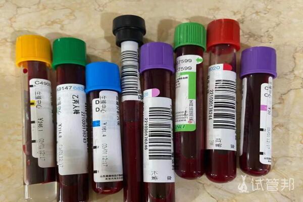 d153a955d95b8a7e20b9249953736711.jpg 内蒙古医科大学附属医院做试管婴儿