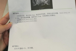 因输卵管堵塞在青岛大学附属医院做试管婴儿，幸得好孕！