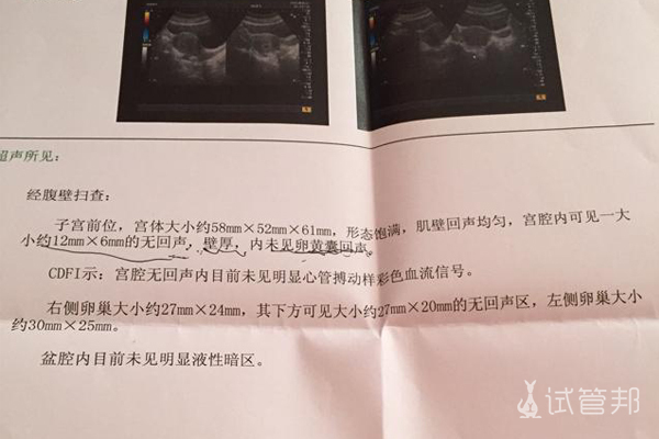 在江苏省人民医院试管婴儿一次成功