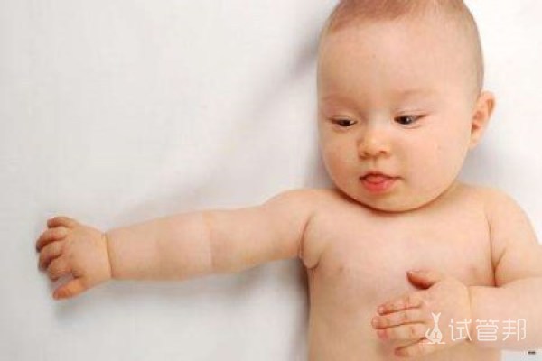 新生儿促甲状腺激素偏高和黄疸有关系吗