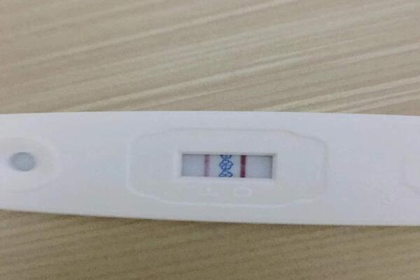 35岁高龄在广州市花都区妇幼保健院试管婴儿终于成功