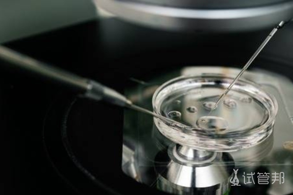 4e8a515f5baed70a225cd8f1e937c83c.jpg 精子碎片率高建议做几代试管婴儿