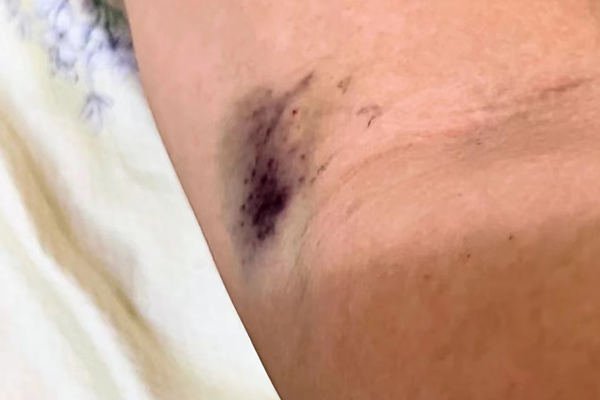 c3f03603d4e5062487bacdfe3d0a3d11.png 华中科技大学同济医学院附属同济医院做试管让我好孕/