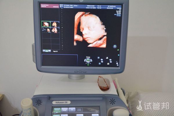六个月四维彩超胎儿清晰图片