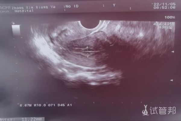 68d624826be365fddafef68d47b8ce2d.jpg 广西壮族自治区人民医院试管婴儿怎么样