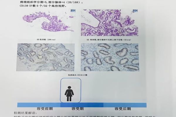 试管婴儿子宫内膜受容性检查结束