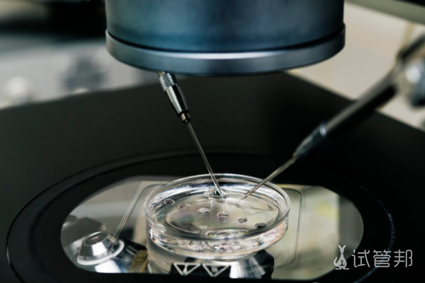 88fe2e05d69bac369c9b4a4577d63996.png 试管婴儿移植后会掉出来吗