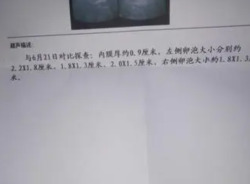 因不明原因不孕，没想到人工授精让我一次成功抱俩！